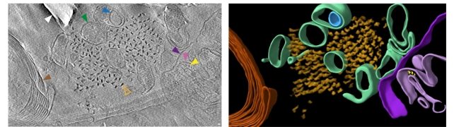 A grey scan next to a colored image showing molecules inside brain tissue